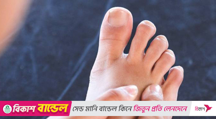 ইউরিক অ্যাসিড বাড়লে যা করতে হবে